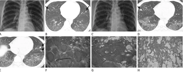 Fig. 1. A 40-year-old female with history of Raynaud’s phenomenon.