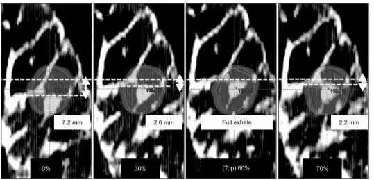 Fig.  5.  4D  CT  images  of  the  lung  phantom  reconstructed  using  phase  based  sorting