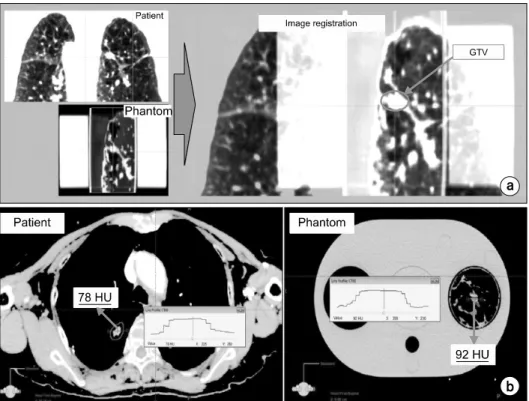 Fig.  6.  (a)  Image  fusion  between  patient  CT  and  lung  phantom  CT. 