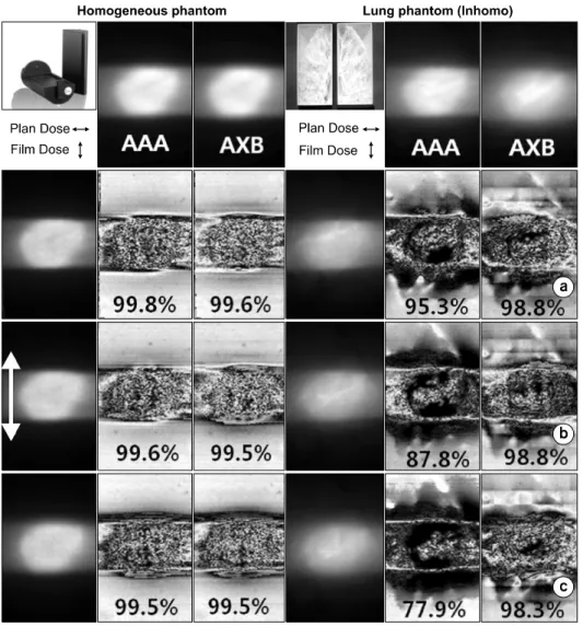 Fig.  8.  The  phantom  study  were  performed  using  the  homogeneous  phantom  and  3D  printed  lung  phantom