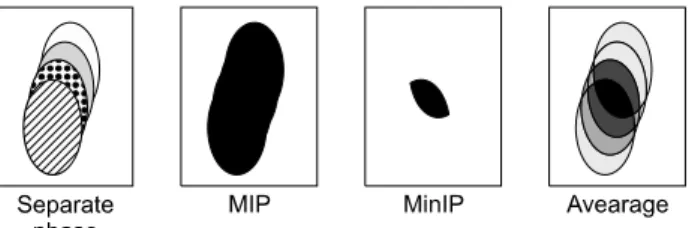 Fig.  8.  Different  intensity  projection  protocols  of  mobile  target. 