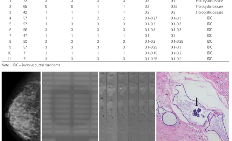 Table 1. Summarizations for Microcalcifications of Mammography and Micro CT of Paraffin Block