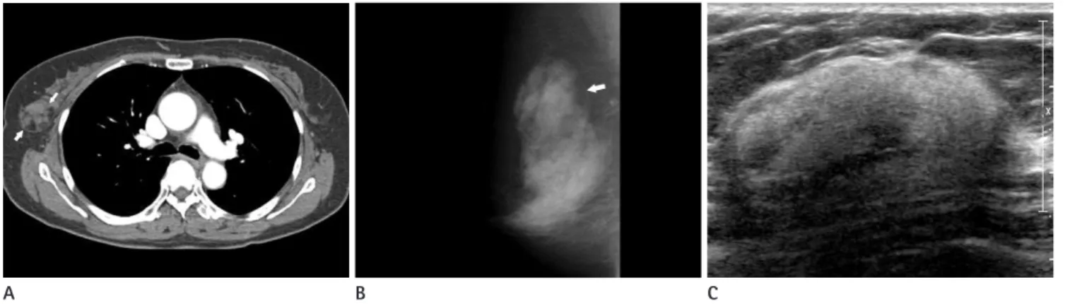 Fig. 1. 61-year-old female. 