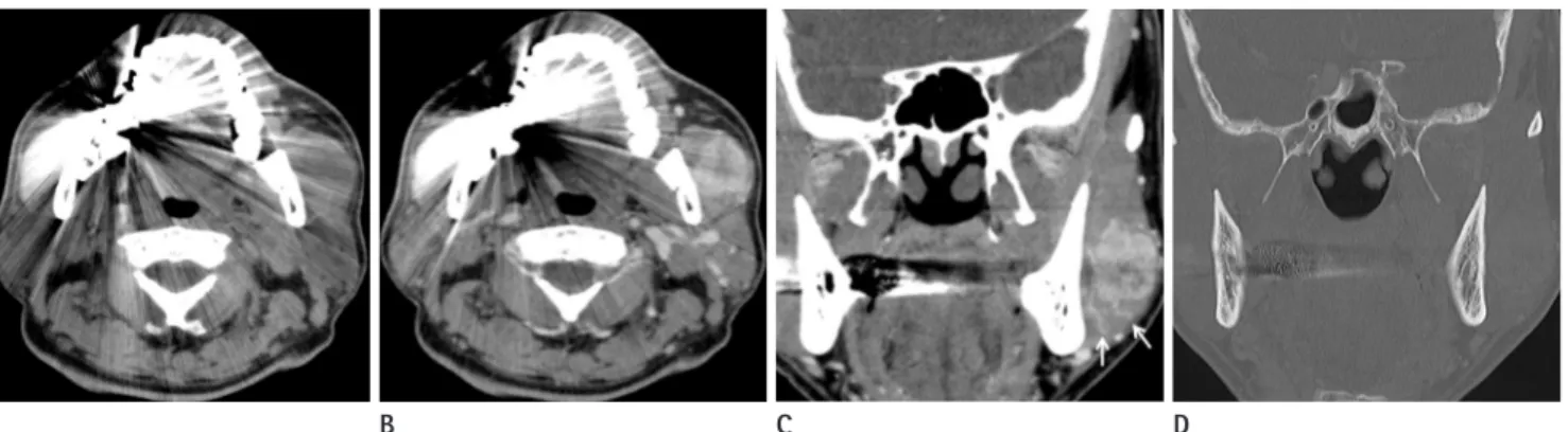 Fig. 2. Pathologic findings of the mass in left masseter muscle. 