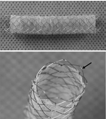 Fig. 1. The triple layered self expanding stent-graft. It was construct- construct-ed by two layers of closconstruct-ed cell nitinol stent and intervening expandconstruct-ed  polytetrafluosoethylene membrane