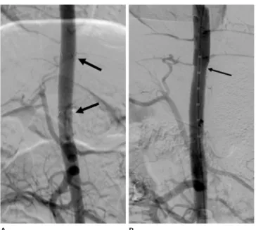 Fig. 3. Macroscopic findings of the stent grafted artery explanted af- af-ter 12 weeks