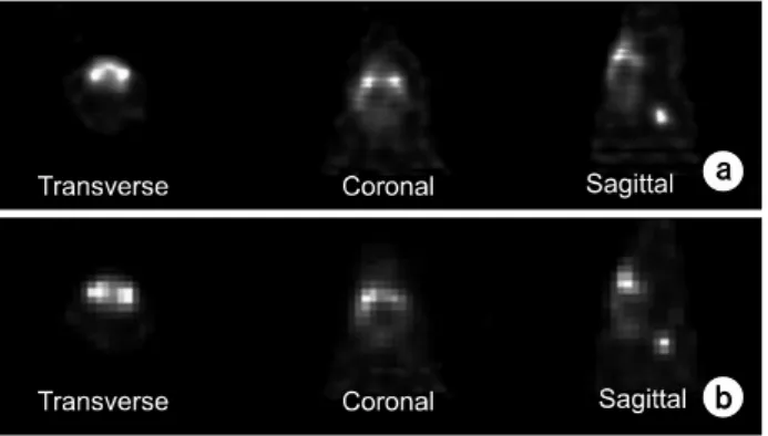Fig.  10.  CdTe-based  SPECT  (a),  NaI(Tl)-based  SPECT  (b)의  Mouse  brain  재구성 영상.