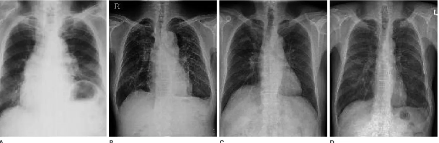 Fig. 3. Relationship of entrance surface dose (ESD) and image quality according to examination method