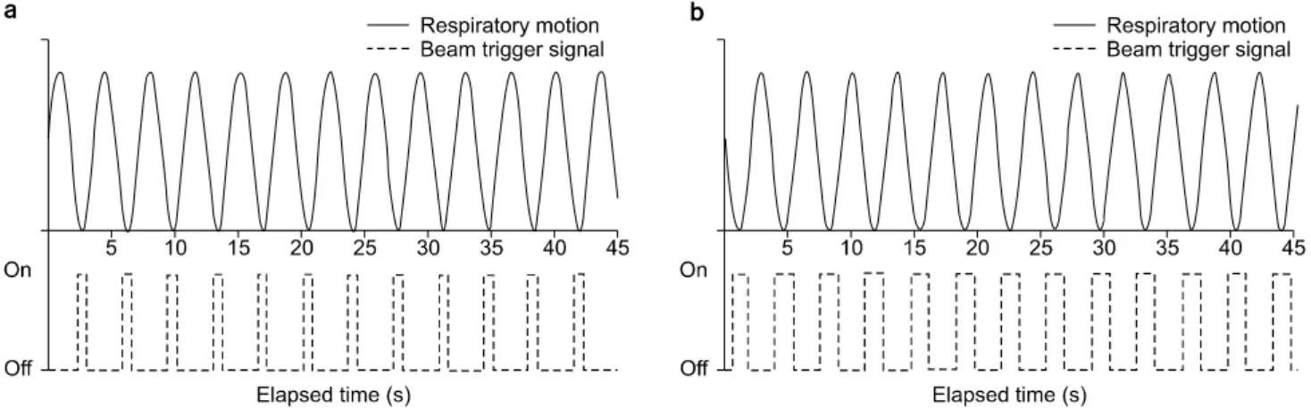 Fig.  4.  (a)  Gating  window  at  40%∼60%  with  5  cm  motion  range,  (b)  Gating  window  at  30%∼70%  with  5  cm  motion  range:  Sum  of  beam  on  time  for  each  gating  level  were  compared  with  total  treatment  time,  respectively.