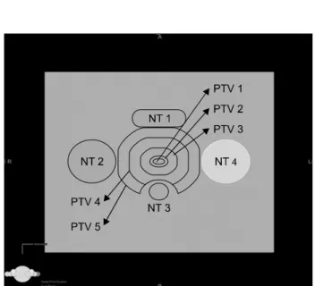 Fig.  2.  Design  of  PTVs  and  normal  tissues  in  the  virtual  phantom.