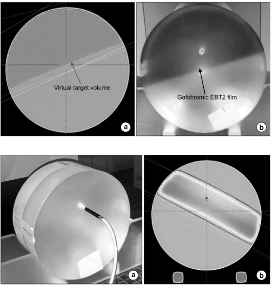 Fig.  1.  Cylindrical  acrylic  phantom  for  the  evaluation  of  the  T-B  IMRT  function  in  the  correction  of   hetero-geneous  dose  distribution