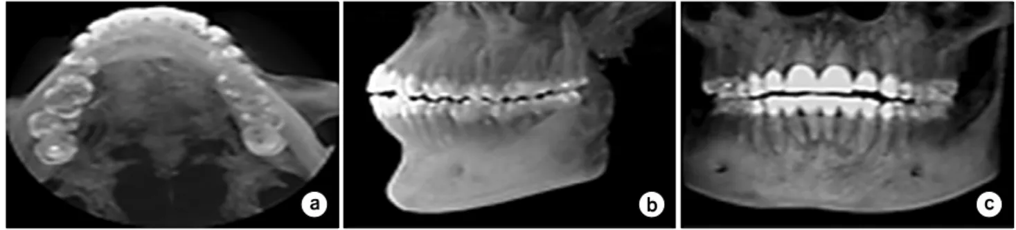 Fig.  7.  Results  for  maximum  intensity  projection  of  dental  CBCT  data  (a)  axial  view  (b)  sagittal  view  (c)  coronal  view.
