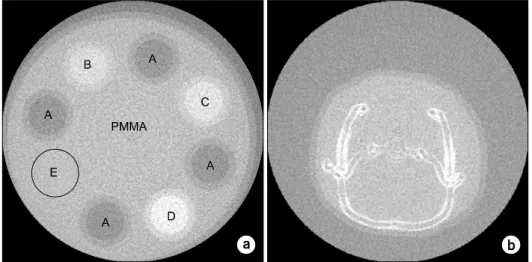 Fig.  1.  Reconstructed  image  as  a  reference  using  FDK  algorithm  at  400  projection  view  for  (a)   cylin-drical  phantom  (A:  Air,  B:  Iodine  1  ml＋Distilled  water  3  ml,  C:  Iodine  1  ml＋Distilled  water  2  ml  D:  Iodine  1  ml＋Distil