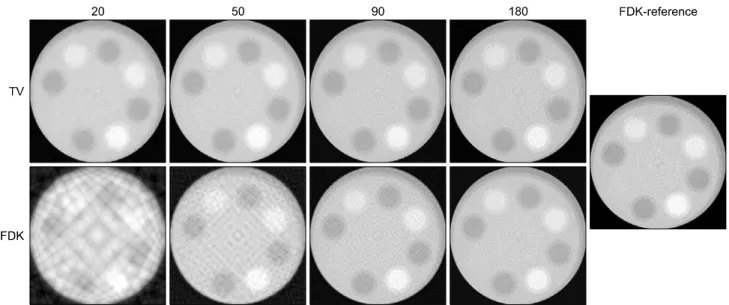 Fig.  3.  Comparison  between  phantom  images  obtained  by  using  TV  minimization  and  FDK  algorithm,  respectively,  at  20,  50,  90,  180  projection  view