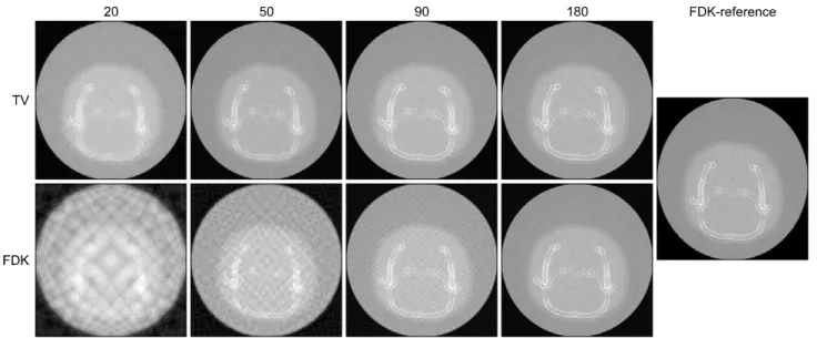 Fig.  6.  Comparison  between  mouse  images  obtained  by  using  TV  minimization  and  FDK  algorithm,  respectively,  at  20,  50,  90,  180  projection  view