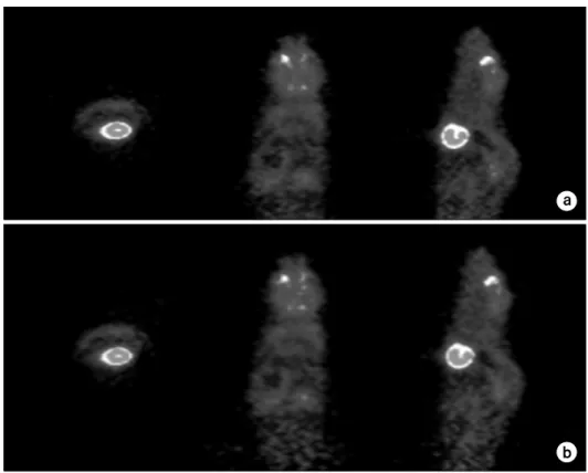 Fig.  6.  Comparison  of  list-mode  based  non-parametric  (LMNP)   boot-strap  method