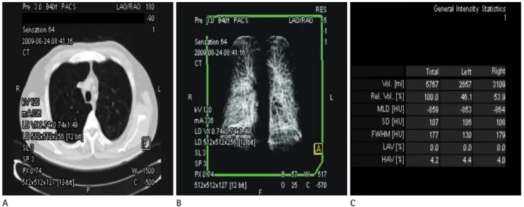 Fig. 1. Workstation images and table of data from a 68-year-old man with COPD. 
