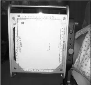 Fig.  5.  Verification  on  Beam  alignment  with  fixation  of  collimator  holder.  The  G0  represents  0  degree,  G90  for  90  degrees  and  G270  for  indication  of  right  and  left  lateral  indications  of  the  gantry  movement  angle
