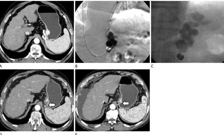 Fig. 1. A 71-year-old male presented with hematemesis.
