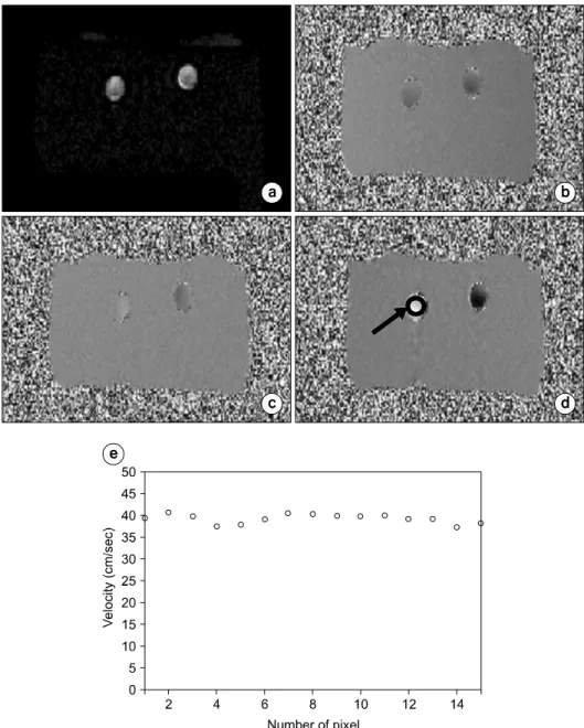 Fig.  6.  The  axial  view  of  flow  phantom  images  obtained  with  a  2D  PC  MRA  pulse  sequence:   Mag-nitude  image  (a),  phase  image  in  frequency  encoding  direction  (right-  left)  (b),  in  phase  encoding   direc-tion  (anterior-posterior
