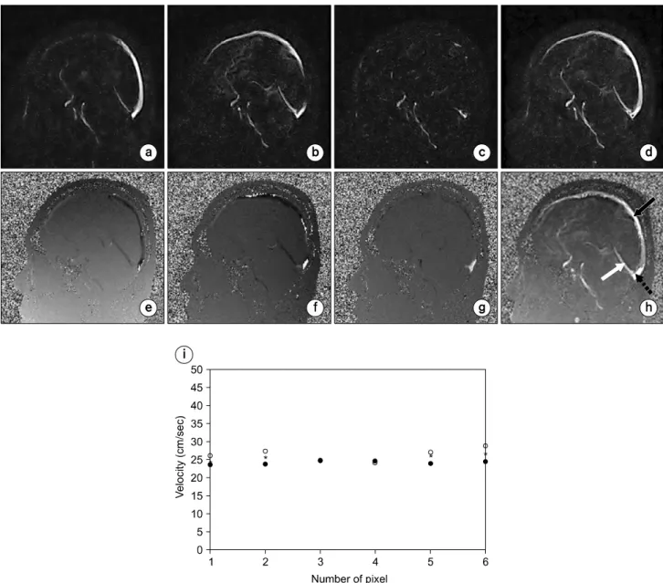 Fig.  7.  Separate  sagittal  display  of  the  flow  sensitivity  data  set  obtained  with  a  2D  PC  MRA  pulse  sequence