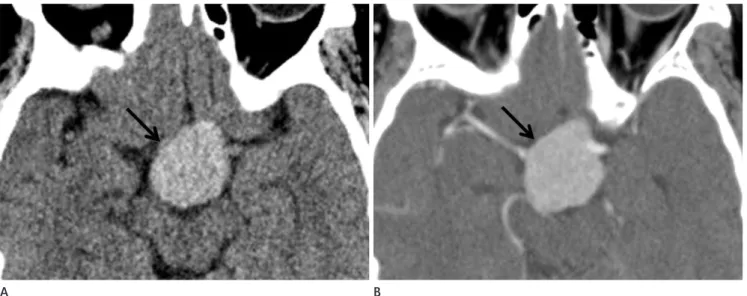 Fig. 1. A 61-year-old woman with a history of reduced visual acuity in her right eye for a period of 3 months