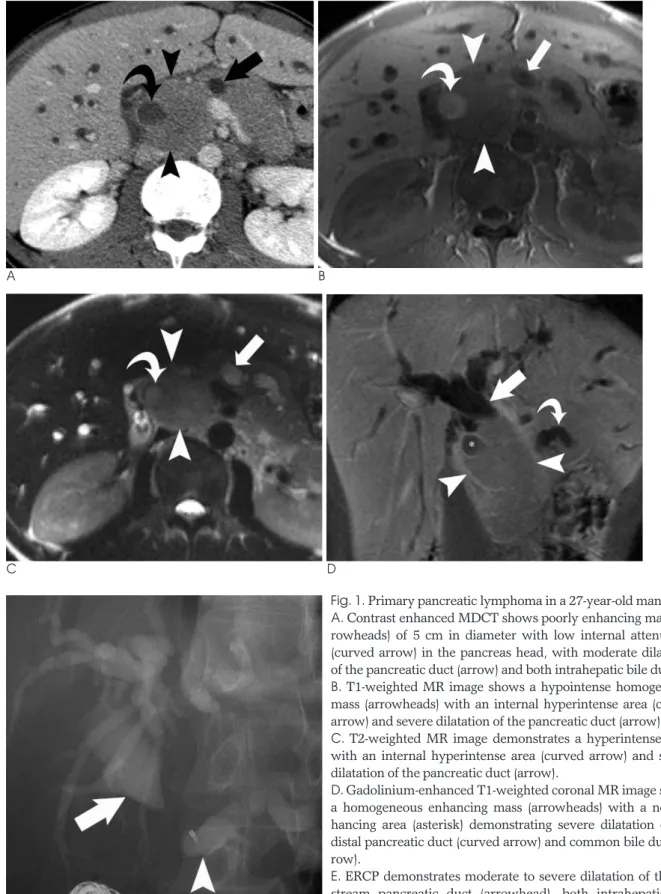 Fig. 1. Primary pancreatic lymphoma in a 27-year-old man.