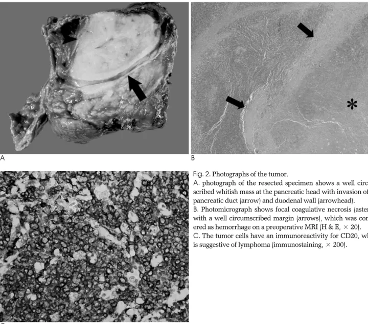 Fig. 2. Photographs of the tumor.