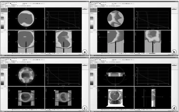 Fig.  2.  The  dosimetric  QA  of  VMAT.  (a)  High-dose  region’s  point-dose  QA  plan  with  a  cylindrical  phantom,  (b)  low-dose  region’s  point-dose  QA  plan  with  a  cylindrical  phantom,  (c)  360-degree  fluence-map  QA  plan  with  ArcCheck,