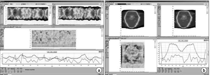 Fig.  5.  The  example  of  dosimetric  QA.  (a)  The  360-degree  intensity-map  evaluation  with  ArcCheck