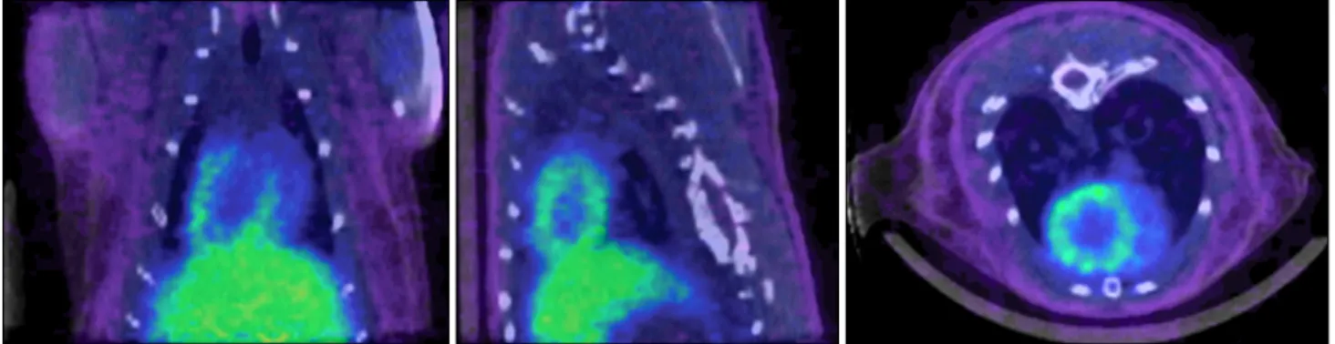 Fig.  2.  Registered  68 Ga-BAPEN  PET  and  CT  images  on  image  fusion  program  FIRE  (Functional  Image  REgistration,  Seoul  National  University,  Seoul,  Korea).