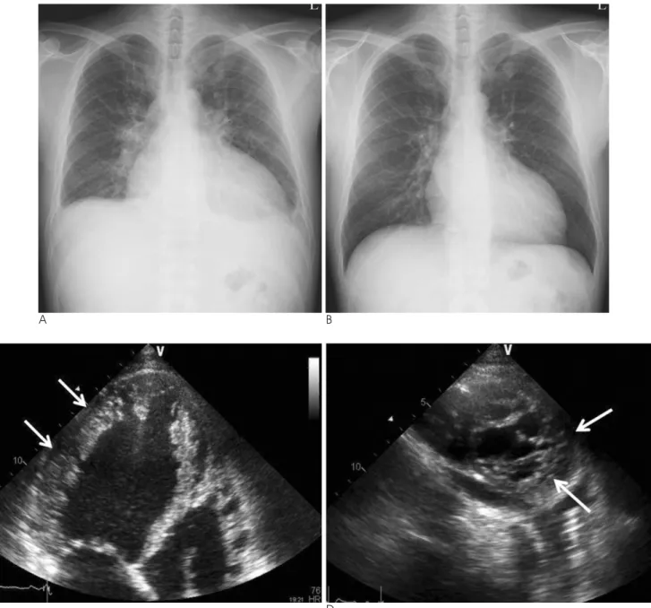 Fig. 1. A 38-year-old male with dyspnea. 