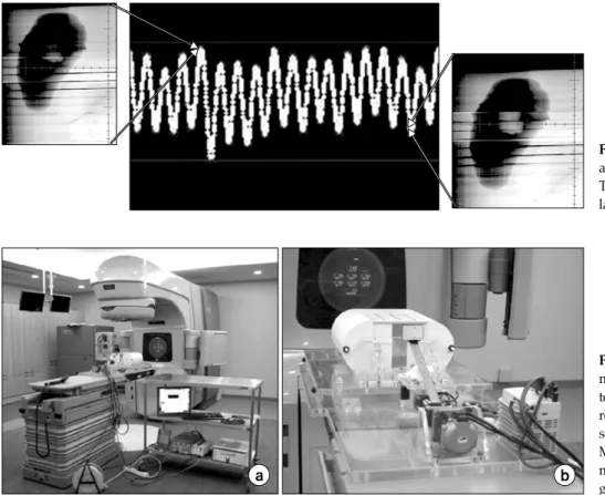 Fig.  2.  Gated  OBI  images  acquired  at  0%  and  50%  phases  of  respiration. 