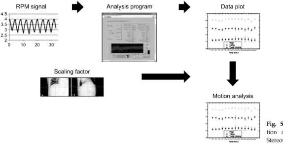 Fig.  5.  Schematic  diagram  of  Mo- Mo-tion  analysis  procedure  for  Liver  Stereotactic  Body  Radiation  Therapy.