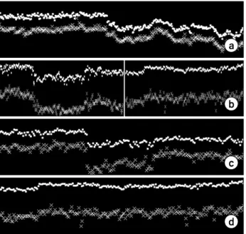 Fig.  6.  Real  patients’  respiration  signals.  (a)  two  large  drifts  and  large  standard  deviations;  treatment  was  changed  to   con-ventional  fraction  after  changing  margin  (b)  larger  movement  than  planned
