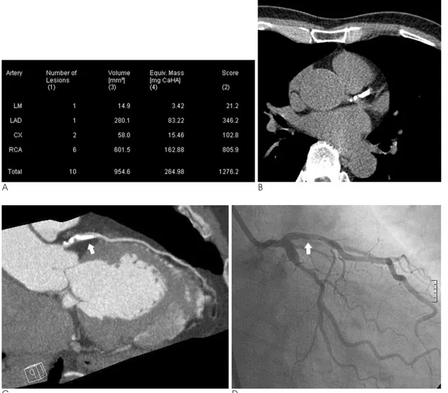 Fig. 2. A 65-year-old man with chest pain.