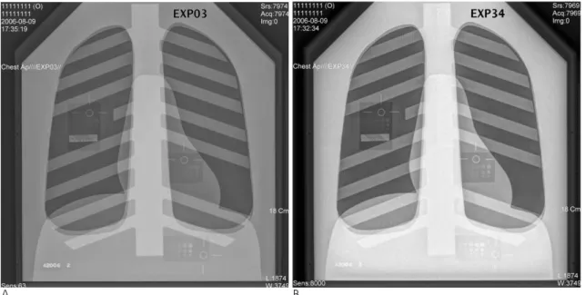 Fig.  1. Correlation of numbers of discs and radiation doses.