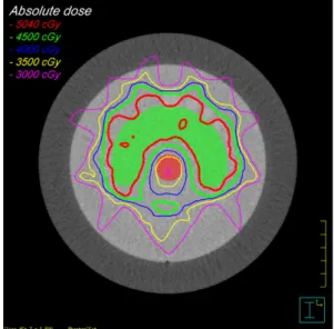Fig.  3.  The  density-CT  number  calibration  curves  of  the  CT  and  the  CBCT  for  dose  calculation  in  the  radiation  therapy  planning  system  (Pinnacle 3 )