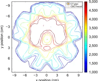 Fig.  4.  Isodose  distributions  of  the  plan  on  the  CT  (solid  lines)  and  the  reconstructed  dose  on  the  CBCT  (dashed  lines)