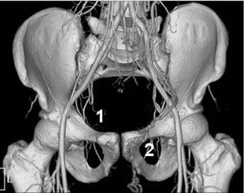 Fig. 12. Coronal volume- rendered image shows anatomic lo- lo-cation of pelvic hernias.