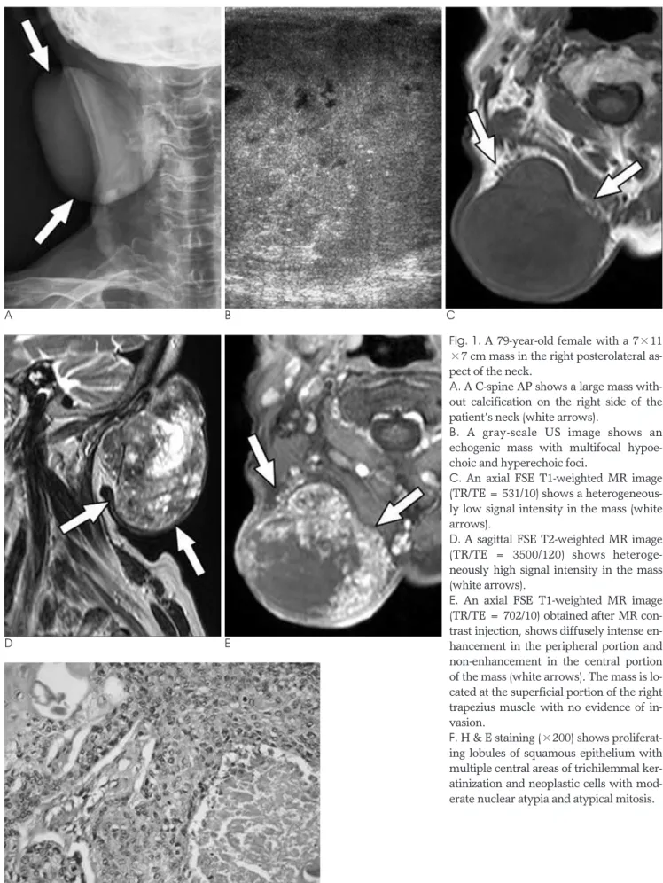 Fig. 1. A 79-year-old female with a 7×11