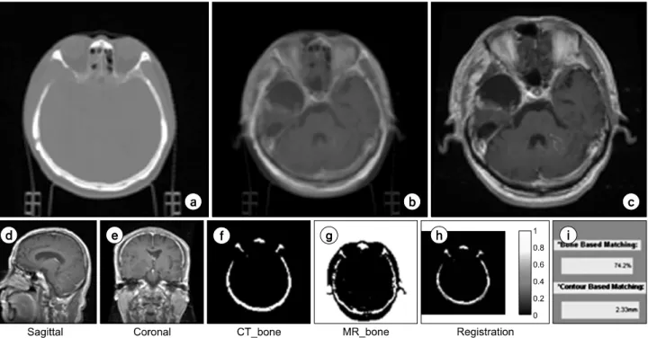 Fig.  4.  The  conventional  tab  for  image  registration  and  evaluation  of  the  registration  accuracy