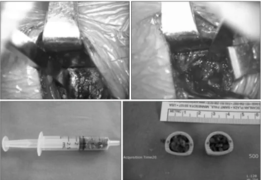Figure 1. Intra-operation finding.