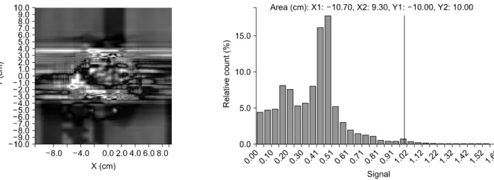 Fig.  5.  Gamma  evaluation  with  spatial  and  dosimetric  limits  of  2  mm  and  3%  between  measurement  and  calculation.