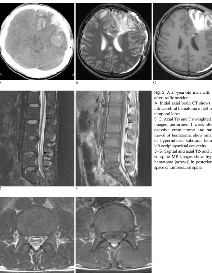 Fig. 2. A 24-year-old man with headache after traffic accident.