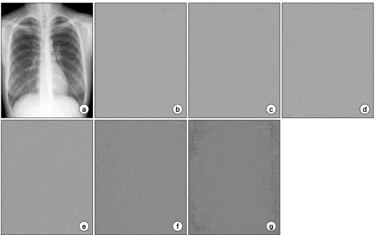 Fig.  3.  Chest  PA  image  (a),  undelayed  unexposed  image  (b),  delayed  unexposed  image  after1  hour  (c),  3  hours  (d),  6  hours  (e),  9  hours  (f),  12  hours  (g)