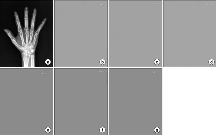 Fig.  4.  Hand  PA  image  (a),  undelayed  unexposed  image  (b),  delayed  unexposed  image  after  1  hour  (c),  3  hours  (d),  6  hours  (e),  9  hours  (f),  12  hours  (g).