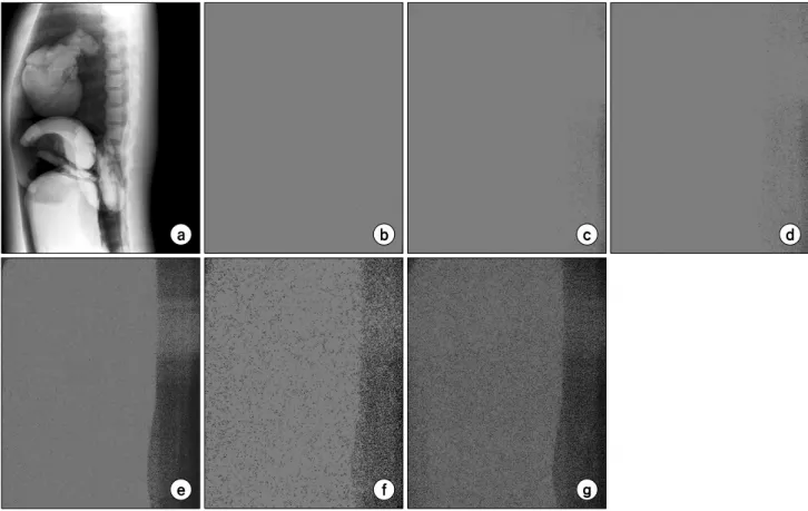 Fig.  5.  L-spine  lateral  image  (a),  undelayed  unexposed  image  (b),  delayed  unexposed  L-spine  lateral  image  after  1  hour  (c),  3  hours  (d),  6  hours  (e),  9  hours  (f),  12  hours  (g).