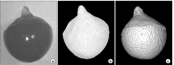 Fig.  1.  3-dimensional  volume  rendering  using  devil’s-tongue  jelly  phantom  of  protrusion  prostate  (a)  devil’s-tongue  jelly  phantom  of  protrusion  prostate  (b)  3-dimensional  volume  rendering  with  CT  (c)  3-dimensional  volume  renderi