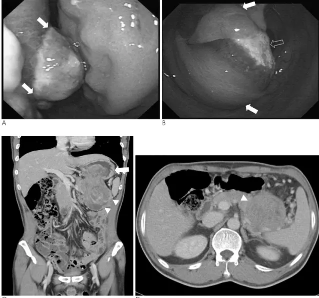 Fig. 1. A 62-year-old man presenting with dizziness. 